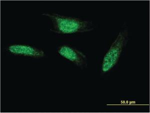 Anti-SEC14L2 Mouse Monoclonal Antibody [clone: 2E5]