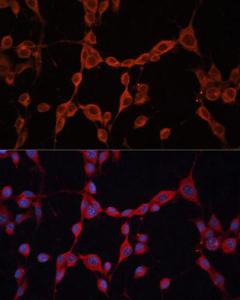 Immunofluorescence analysis of NIH-3T3 cells using Anti-GNA13 Antibody (A306847) at a dilution of 1:100 (40x lens) DAPI was used to stain the cell nuclei (blue)