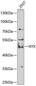 Western blot analysis of extracts of 293T cells, using Anti-Nyctalopin Antibody (A12175) at 1:1000 dilution. The secondary Antibody was Goat Anti-Rabbit IgG H&L Antibody (HRP) at 1:10000 dilution. Lysates/proteins were present at 25 µg per lane