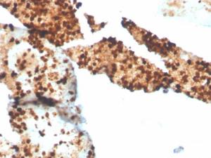 Immunohistochemical analysis of formalin-fixed, paraffin-embedded human spleen using Anti-S100P Antibody [S100P/4386R]