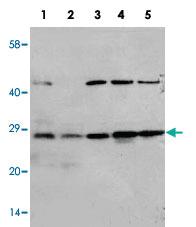 Anti-CA1 Rabbit Polyclonal Antibody