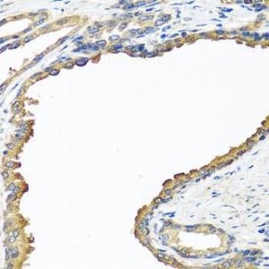 Immunohistochemistry analysis of paraffin-embedded human prostate using Anti-Nyctalopin Antibody (A12175) at a dilution of 1:100 (40X lens)