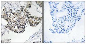 Anti-RSAD1 antibody