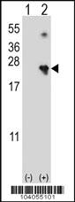 Anti-NME4 Rabbit Polyclonal Antibody