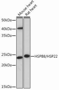 Western blot analysis of extracts of various cell lines, using Anti-Hsp22/HSPB8 Antibody [ARC0715] (A306849) at 1:1000 dilution. The secondary Antibody was Goat Anti-Rabbit IgG H&L Antibody (HRP) at 1:10000 dilution. Lysates/proteins were present at 25 µg per lane