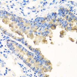 Immunohistochemistry analysis of paraffin-embedded mouse lung using Anti-Nyctalopin Antibody (A12175) at a dilution of 1:100 (40X lens)