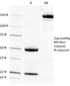 SDS-PAGE analysis of Anti-Cytokeratin 7 Antibody [KRT7/903] under non-reduced and reduced conditions; showing intact IgG and intact heavy and light chains, respectively. SDS-PAGE analysis confirms the integrity and purity of the Antibody