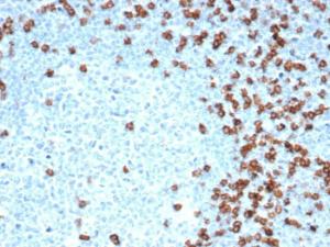 Immunohistochemical analysis of formalin-fixed, paraffin-embedded human tonsil using Anti-CD8A Antibody [CD8/4391R]