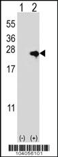 Anti-NME4 Rabbit Polyclonal Antibody