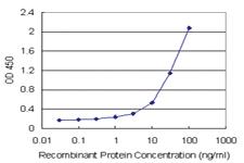 Anti-E2F6 Polyclonal Antibody Pair