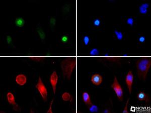 Anti-Neurokinin B Rabbit Polyclonal Antibody