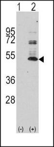 Anti-MAPT Rabbit Polyclonal Antibody (Biotin)