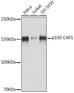 Western blot analysis of extracts of various cell lines, using Anti-p150 CAF1 / CAF Antibody [ARC2011] (A308038) at 1:1,000 dilution. The secondary antibody was Goat Anti-Rabbit IgG H&L Antibody (HRP) at 1:10,000 dilution.