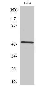 Anti-RSAD1 antibody