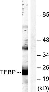 Anti-TEBP antibody