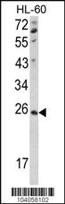 Anti-NME4 Rabbit Polyclonal Antibody