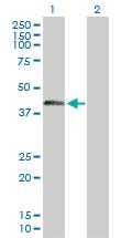 Anti-SPESP1 Mouse Polyclonal Antibody