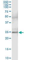 Anti-CEACAM21 Polyclonal Antibody Pair