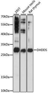 Anti-DHDDS antibody