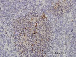 Anti-PIK3CB Mouse Monoclonal Antibody [clone: 4H2]