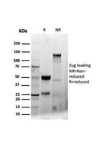 SDS-PAGE analysis of Anti-CD8A Antibody [CD8/4391R] under non-reduced and reduced conditions; showing intact IgG and intact heavy and light chains, respectively. SDS-PAGE analysis confirms the integrity and purity of the antibody.