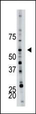 Anti-PFKFB4 Rabbit Polyclonal Antibody