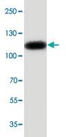 Anti-PGR Rabbit Polyclonal Antibody