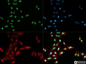 Anti-ABCF2 Rabbit Polyclonal Antibody