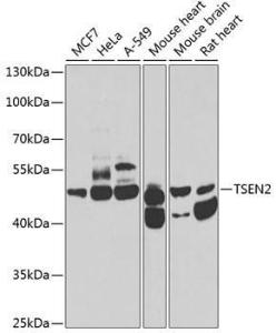 Antibody anti-TSEN2 100 µl