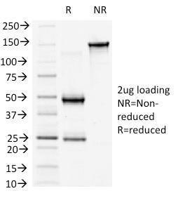 SDS-PAGE analysis of Anti-beta Catenin Antibody [6F9] under non-reduced and reduced conditions; showing intact IgG and intact heavy and light chains, respectively SDS-PAGE analysis confirms the integrity and purity of the antibody