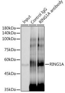 Anti-RING1 antibody