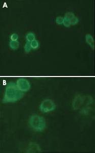 Anti-TYRO3 Mouse Monoclonal Antibody [clone: 6D6F10]