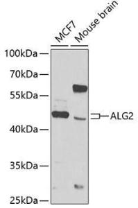 Western blot analysis of extracts of various cell lines, using Anti-ALG2 Antibody (A12179) at 1:1,000 dilution The secondary antibody was Goat Anti-Rabbit IgG H&L Antibody (HRP) at 1:10,000 dilution Lysates/proteins were present at 25 µg per lane