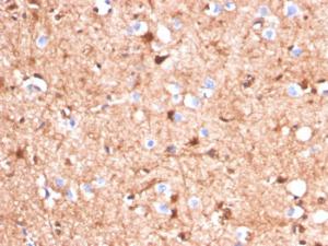 Immunohistochemical analysis of formalin-fixed, paraffin-embedded human cerebellum using Anti-S100 beta Antibody [S100B/4140]