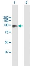 Anti-CDH13 Rabbit Polyclonal Antibody