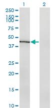 Anti-IDO1 Mouse Monoclonal Antibody [clone: 1C1]