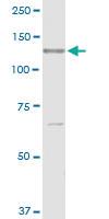 Anti-RECK Rabbit Polyclonal Antibody