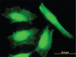 Anti-NXN Mouse Polyclonal Antibody