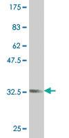 Anti-ZIC1 Mouse Monoclonal Antibody [clone: 1A8]