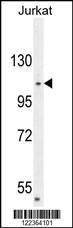 Anti-CENPC Rabbit Polyclonal Antibody (HRP (Horseradish Peroxidase))