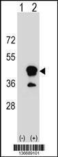 Anti-CD1B Rabbit Polyclonal Antibody (Biotin)