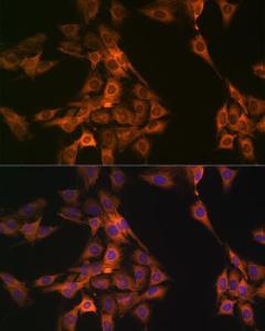 Immunofluorescence analysis of C6 cells using Anti-NAP1L1 Antibody [ARC1888] (A306850) at a dilution of 1:100 (40x lens). DAPI was used to stain the cell nuclei (blue).