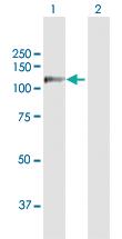 Anti-RECK Rabbit Polyclonal Antibody