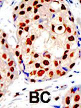 Anti-PRMT1 Rabbit Polyclonal Antibody (FITC (Fluorescein))