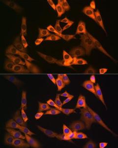 Immunofluorescence analysis of NIH-3T3 cells using Anti-NAP1L1 Antibody [ARC1888] (A306850) at a dilution of 1:100 (40x lens). DAPI was used to stain the cell nuclei (blue).