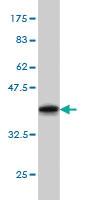 Anti-GRK1 Mouse Monoclonal Antibody [clone: 1G8]