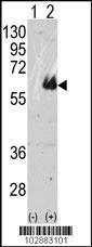 Anti-MAPT Rabbit Polyclonal Antibody (Biotin)