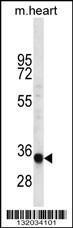 Anti-LIX1L Rabbit Polyclonal Antibody (APC (Allophycocyanin))