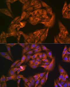 Immunofluorescence analysis of U-2 OS cells using Anti-NAP1L1 Antibody [ARC1888] (A306850) at a dilution of 1:100 (40x lens). DAPI was used to stain the cell nuclei (blue).