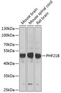 Western blot analysis of extracts of various cell lines, using Anti-PHF21B Antibody (A12181) at 1:1000 dilution